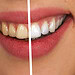 astuces naturelles pour avoir des dents plus blanches